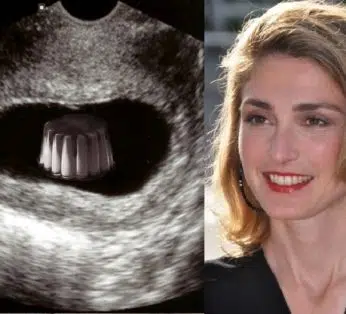 Julie Gayet enceinte de François Hollande puis mariés en 2022