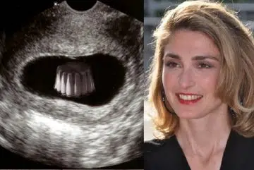 Julie Gayet enceinte de François Hollande puis mariés en 2022