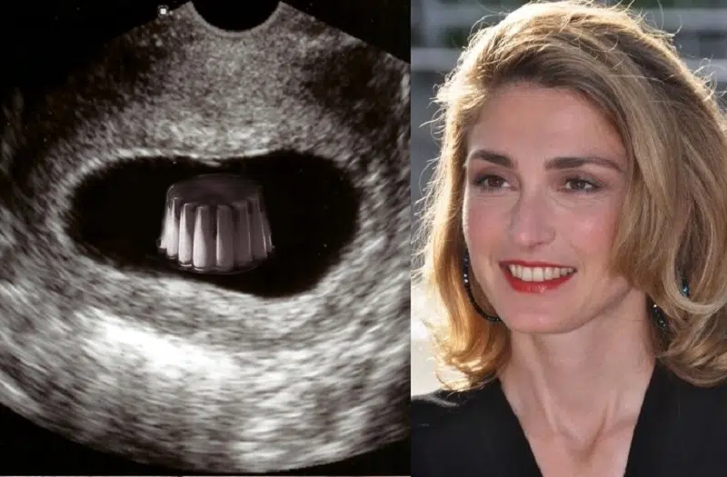 Julie Gayet enceinte de François Hollande puis mariés en 2022